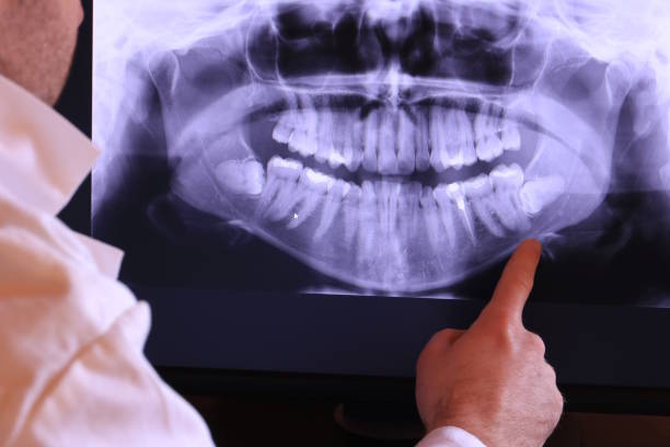 Best Urgent Care for Lost Fillings or Crowns in New Lexington, OH