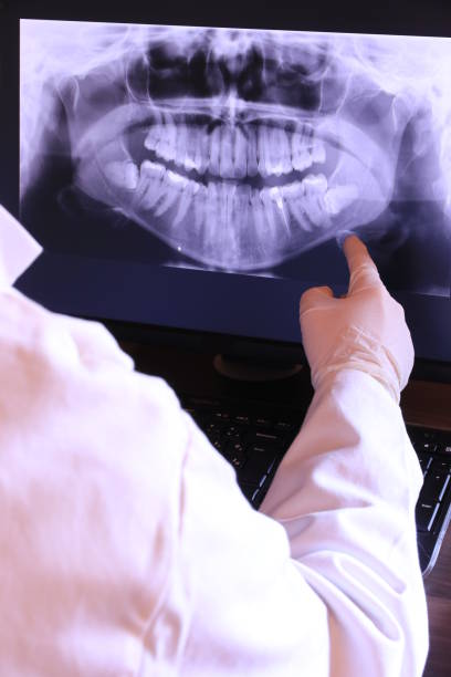 Best Emergency Tooth Extraction in New Lexington, OH