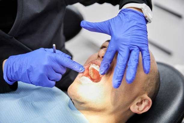 Best Emergency Tooth Extraction in New Lexington, OH