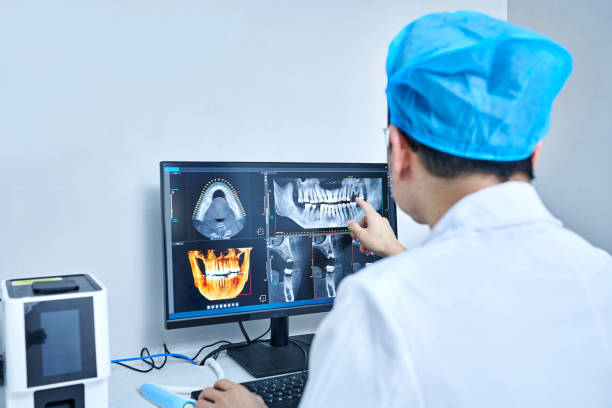 Best Emergency Wisdom Teeth Removal in New Lexington, OH